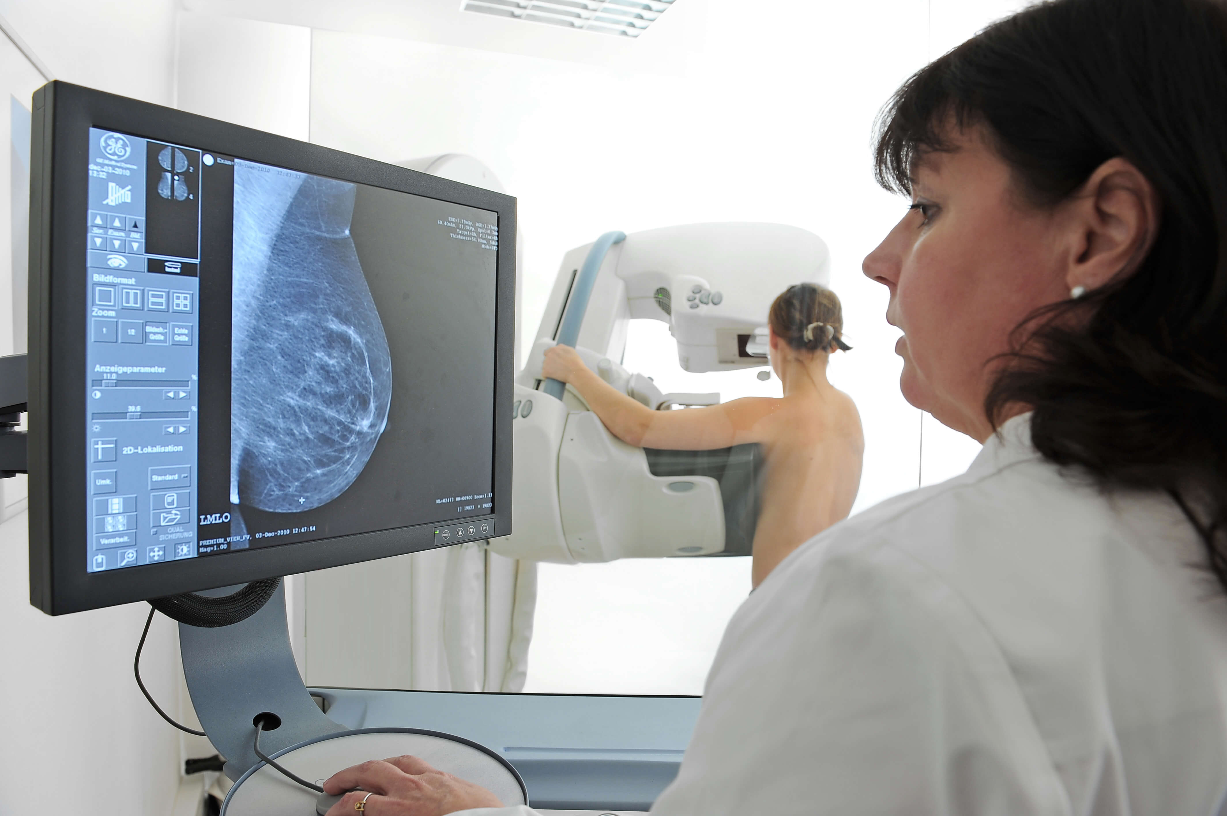 Patientin bei der Mammographie-Untersuchung
